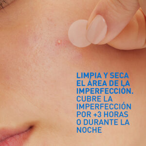 CERAVE PARCHES CONTROL IMPERFECCIONES